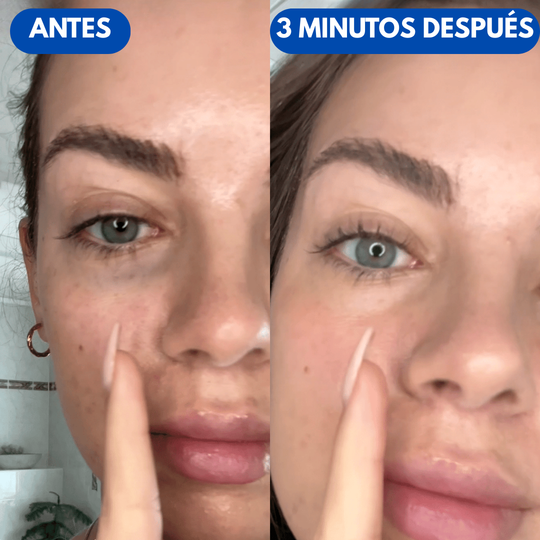 FlashFirm™ |  Crema Anti Bolsas Instantánea
