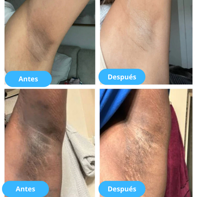 Plenia™ Peel Shot - Exfoliante Corporal Aclarante | 1+1 GRATIS