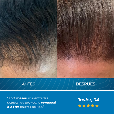 Plenia™ | Roll-On Reactivador de Cabello