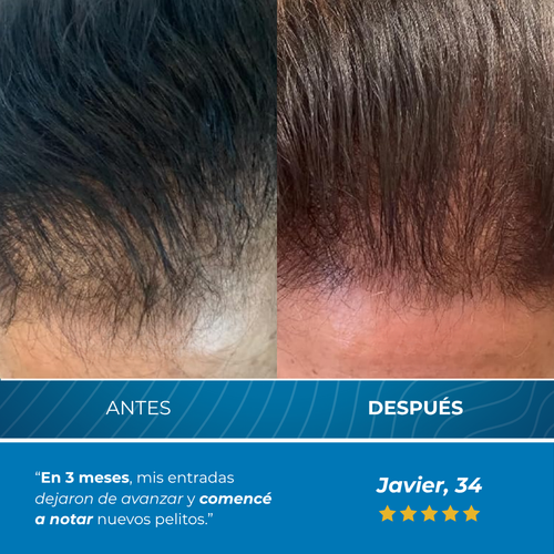 Plenia™ | Roll-On Reactivador de Cabello