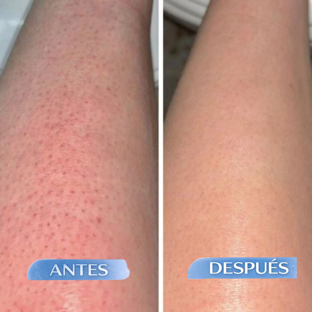 Sheizy™ - Aceite Natural para una Depilación Duradera y Efectiva