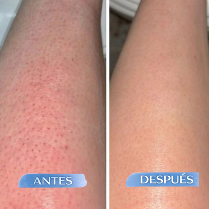 Sheizy™ - Aceite Natural para una Depilación Duradera y Efectiva