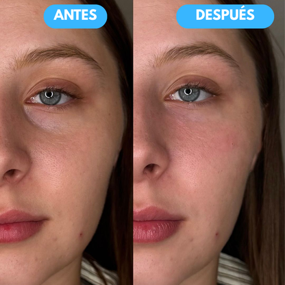 Sovana Eye™ - El único Corrector de Ojeras con tecnología SkinSync™
