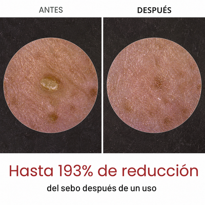 Plenia Peel Shot - Exfoliante de arroz | 1+1 GRATIS