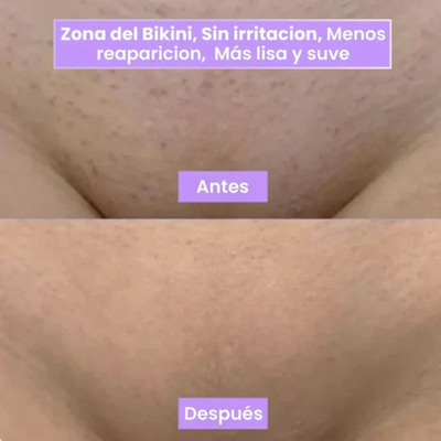 Plenia Hair™ | El Spray Revolucionario que frena el vello