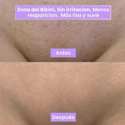 Plenia Hair™ | El Spray Revolucionario que frena el vello